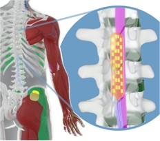 Epidural stimulation rehabilitation